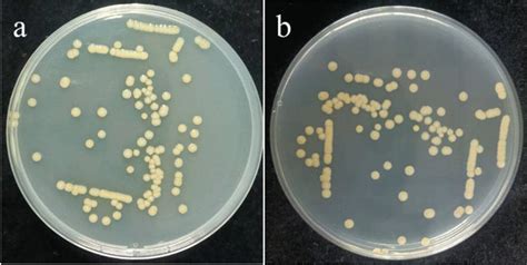 Colony morphology of Pseudomonas sp. Y-5 on LB agar medium. a Front of ...