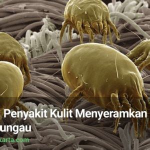 Scabies, Tungau Pembuat Penyakit Kulit Mengerikan | FUMIDA