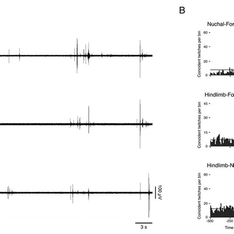 Correlated bouts of myoclonic twitches in multiple muscle groups (A)... | Download Scientific ...