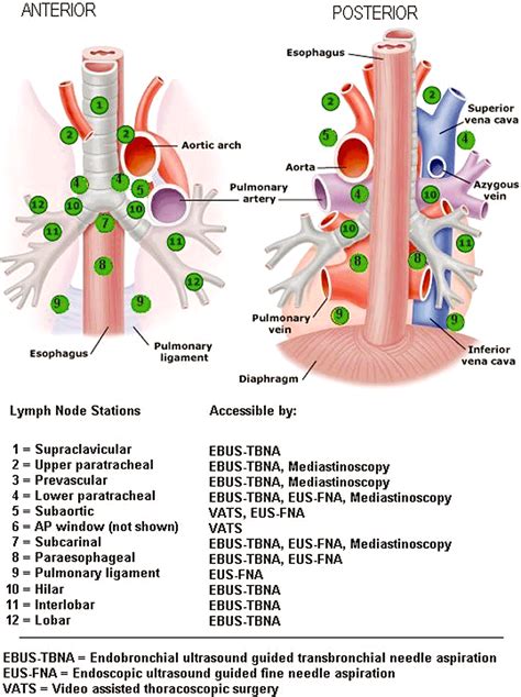 Endobronchial ultrasound (EBUS) with tranbronchial needle aspiration (TBNA) versus ...