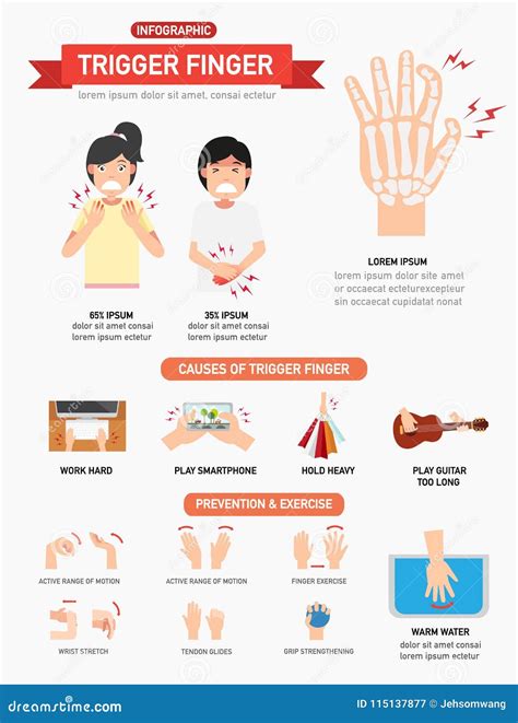 Trigger Finger Causes And Symptoms Illustration Cartoon Vector | CartoonDealer.com #164534707