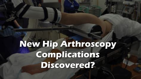 new hip arthroscopy complications | Hip arthroscopy, Hips, Surface