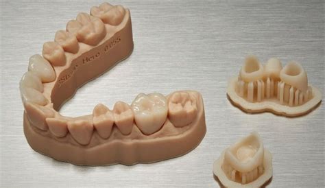 Dental 3D Printing Market Report 2027 | Medi-Tech Insights