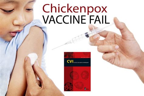 Chickenpox vaccine when mandated increases disease outbreak, South ...