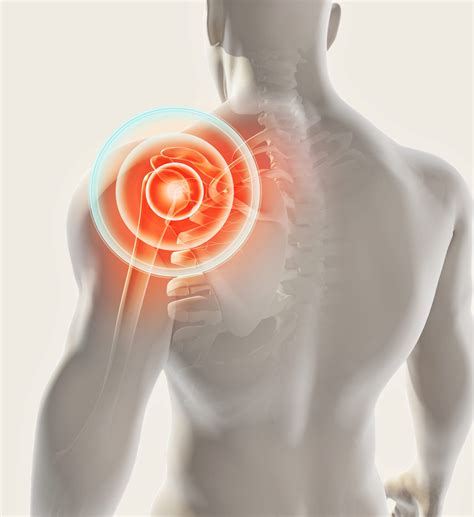 Labral Tear in the Shoulder