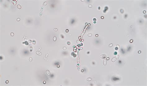 The Counting Yeast Cells Microscope: A Brewer’s Must Have