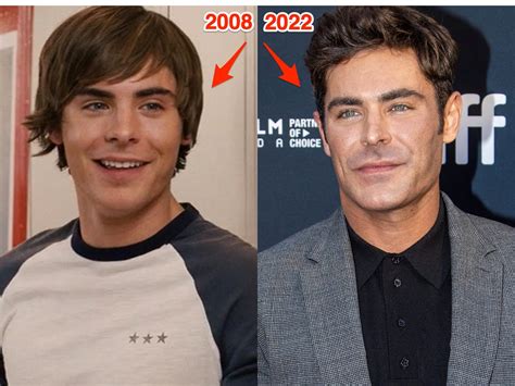 Zac Efron says he 'almost died' in the severe accident that shattered his jaw and led people to ...