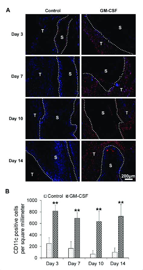 (A) The human dendritic cells (CD11c + ) distribution in harvested... | Download Scientific Diagram