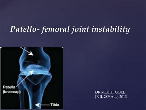 Patello femoral joint - MRI | PPT