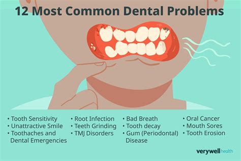 Mouth Infection Types With Pictures - Infoupdate.org