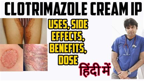 Clotrimazole Cream IP | Clotrimazole Cream Uses, Side effects, Dose ...