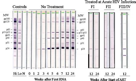 (Left) Evolution of HIV-1 Western blot (WB) assay profiles of an ...