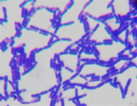 Gram Positive Bacteria Characteristics