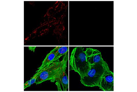 Fibronectin/FN1 (E5H6X) Rabbit mAb (Alexa Fluor® 647 Conjugate) | Cell ...