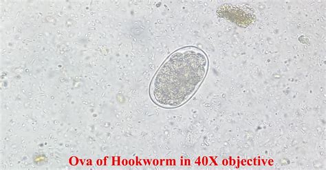 MICROBIOLOGY BLOG FOR STUDENTS (MBLOGSTU): OVA OF HOOKWORM