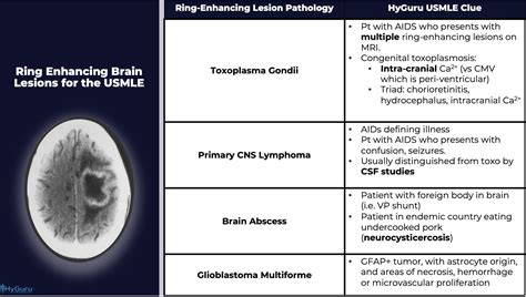 Ring Enhancing Brain Lesion for the USMLE (DDx) : r/Step2