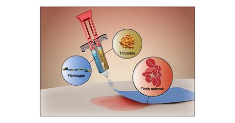 Fibrin Sealants: Challenges and Solutions | ACS Biomaterials Science & Engineering