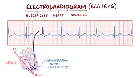 ECG basics: Video, Anatomy, Definition & Function | Osmosis