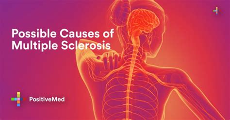 Possible Causes of Multiple Sclerosis - PositiveMed