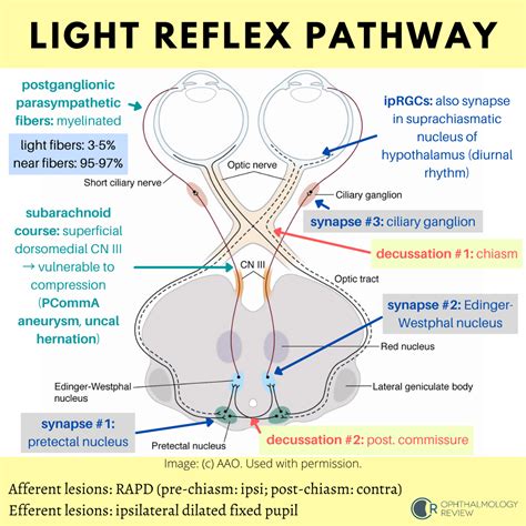 The Light Reflex Pathway — Ophthalmology Review