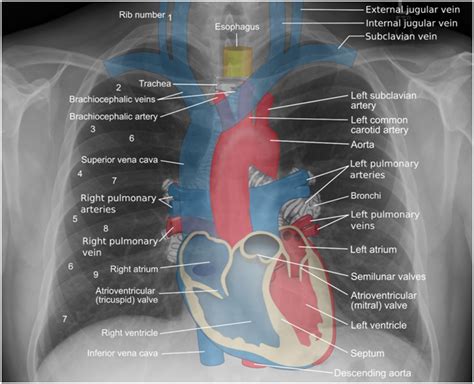 Why You Might Have Fluid Around Your Heart – And What To Do About It