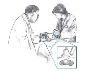 Kidney Biopsy - NIDDK