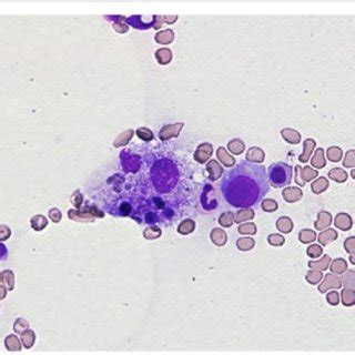 a Histology of the tumor in the nasal cavity. The neoplastic cells have... | Download Scientific ...