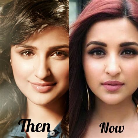 Parineeti Chopra Before And After