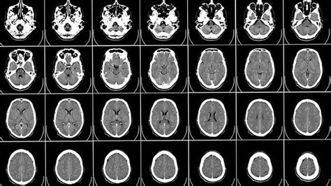 Brain Imaging Breakthrough May Offer MRI Alternative | Technology Networks