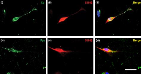 Cell surface expression of Fpn and Cp in Schwann cells. Schwann cells... | Download Scientific ...