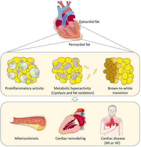 Epicardial adipose tissue: an emerging biomarker of cardiovascular complications in type 2 ...