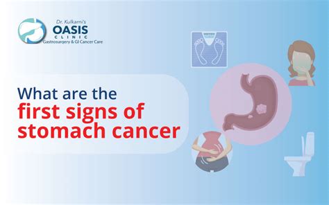 what is the first sin of stomach cancer?