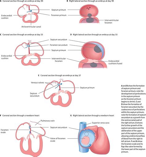 Development of the heart and the fetal circulation | Obgyn Key