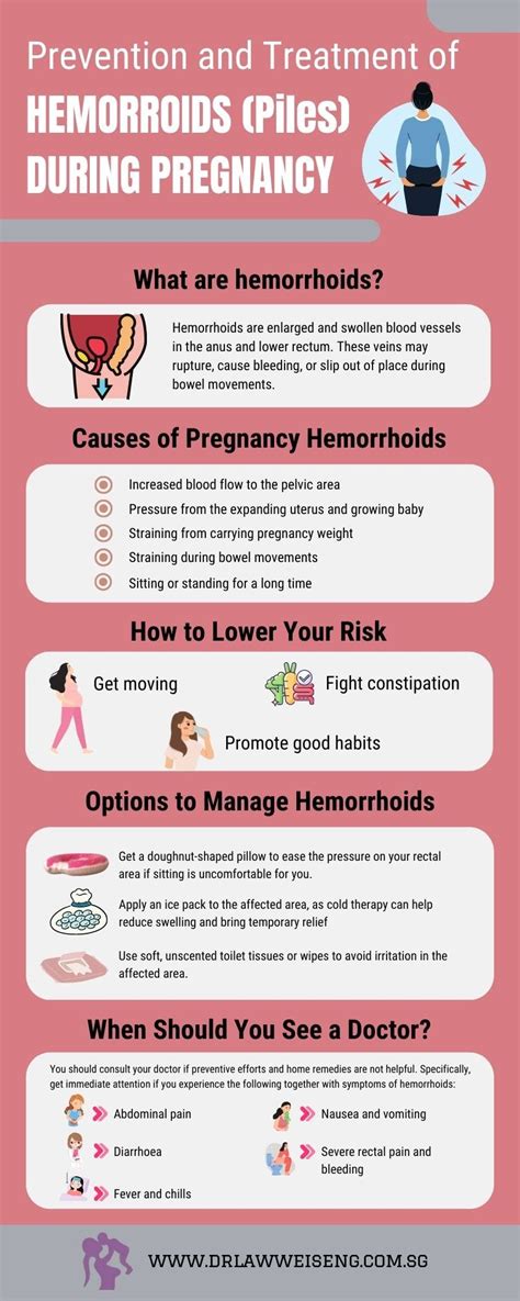 Prevention and Treatment of Hemorrhoids (Piles) During Pregnancy - Emily Teo - Medium