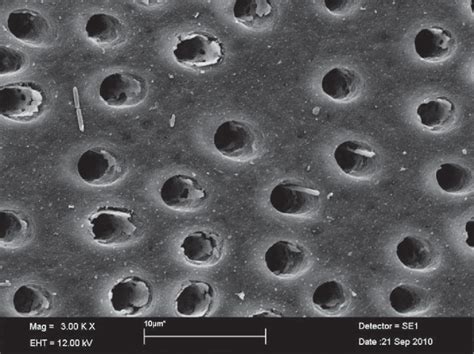 Scanning electron microscope image of bacteria entering dentinal tubules | Download Scientific ...