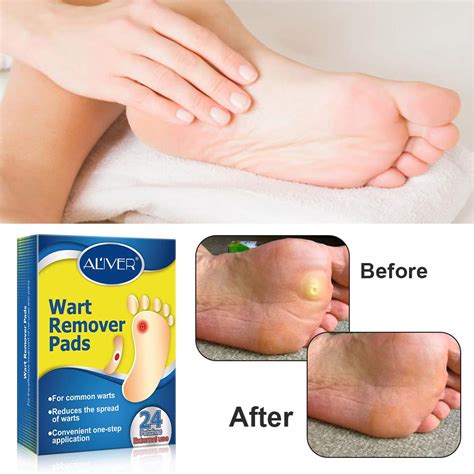 Buy Wart Remover, Corn Remover Pads, Foot Corn Removal Plaster with Hole, Professional Removes ...