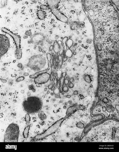 Transmission Electron Microscope Images Of Cells