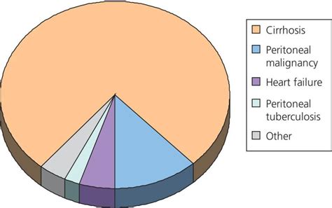 59: Ascites and its complications | Abdominal Key