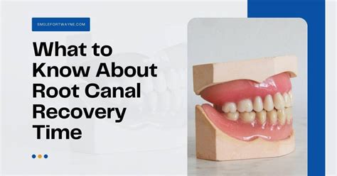 What to Know About Root Canal Recovery Time - Family Dentistry ...