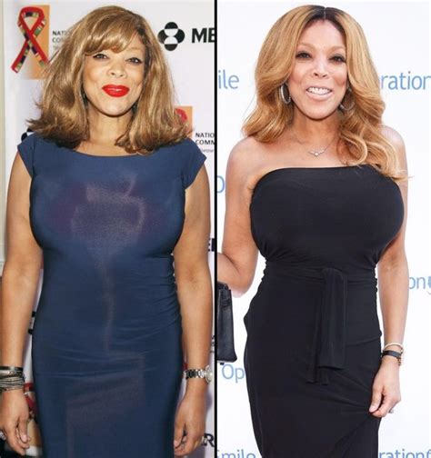 Wendy Williams before and after plastic surgeries - plasticsurgerypro.info