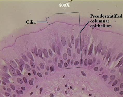 Pseudostratified columnar epithelium - Wikipedia