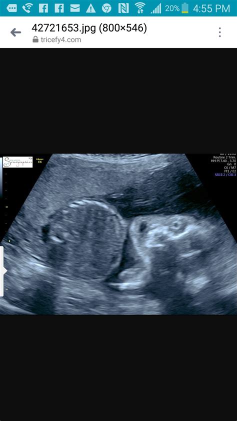 My creepy ultrasound... : r/WTF