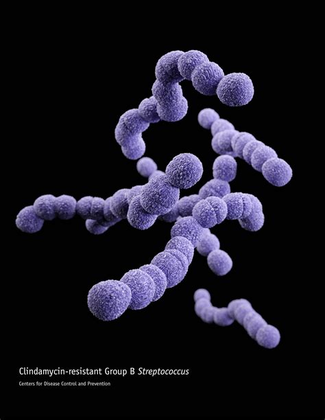 Medical illustration of Streptococcus agalactiae. Streptococcus Agalactiae, Flesh Eating ...