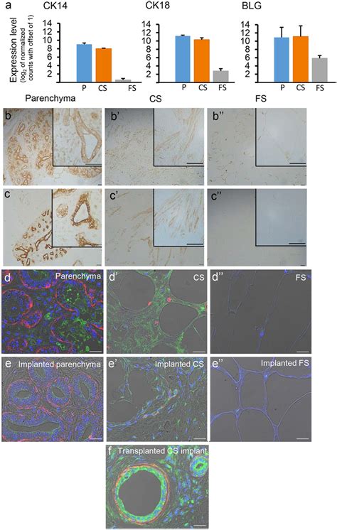 Epithelial cell markers that are highly expressed in the close stroma ...