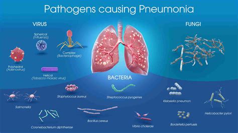 How Pneumonia Can Kill You & How to Prevent It - Denver Concierge Medicine