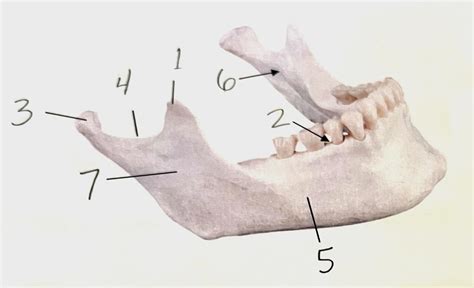 Mandible Bone Markings Quiz Diagram | Quizlet