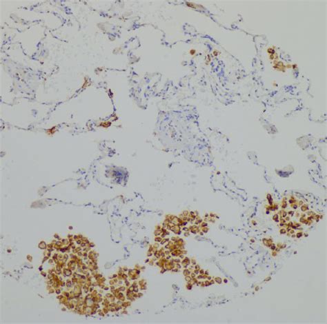 CD11c Antibody | Ionpath