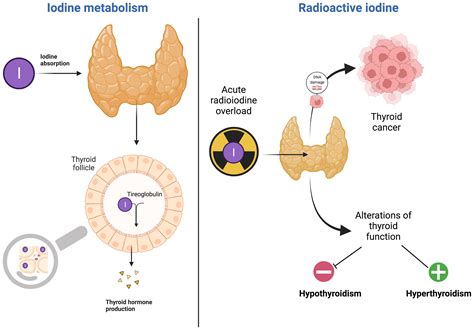 Frontiers | The Iodine Rush: Over- or Under-Iodination Risk in the ...