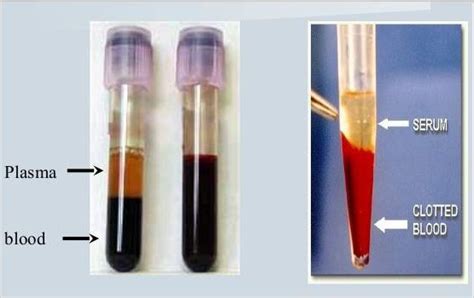 How are Plasma and Serum different from each other?