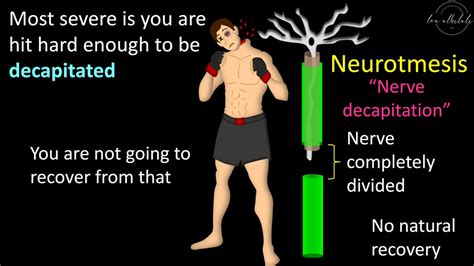 1/Is trying to understand peripheral nerve injury getting on your last nerve? Is the brachial ...